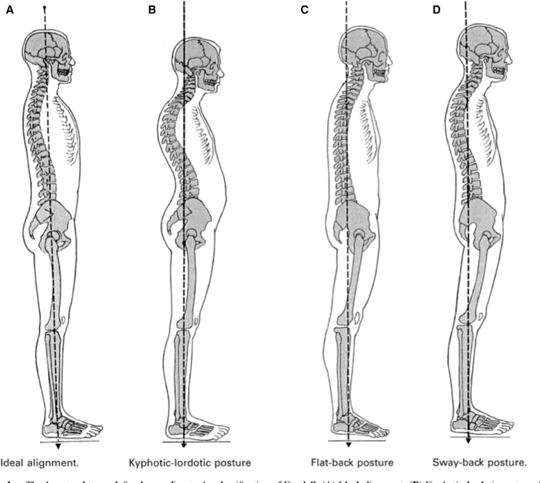 Ideal Posture