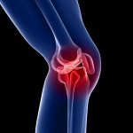 PhysiYoga Knee Pain