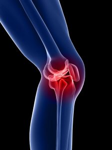 PhysiYoga Knee Pain