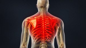 Thoracic pain physiyoga