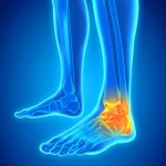 Foot and Ankle Pain at PhysiYoga