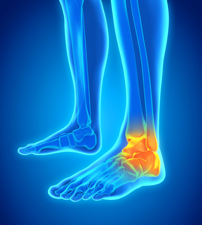 Foot and Ankle Pain at PhysiYoga