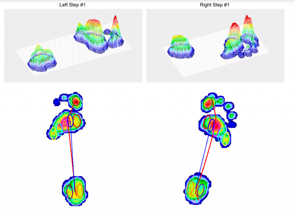 PhysiYoga Gait analysis