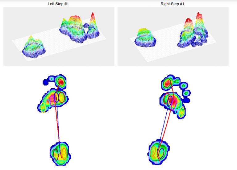 PhysiYoga Gait analysis